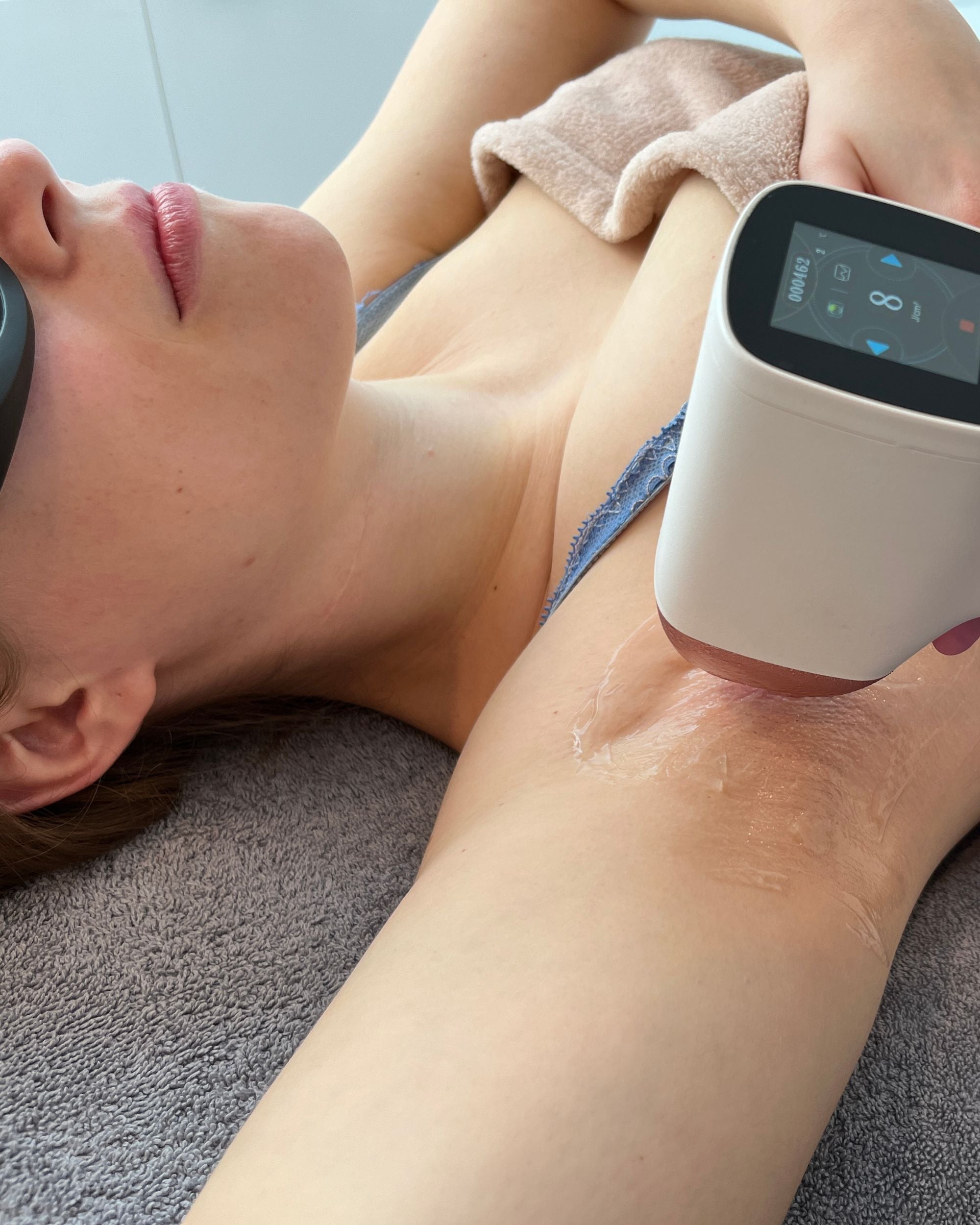 Plan een afspraak en start met laserontharing